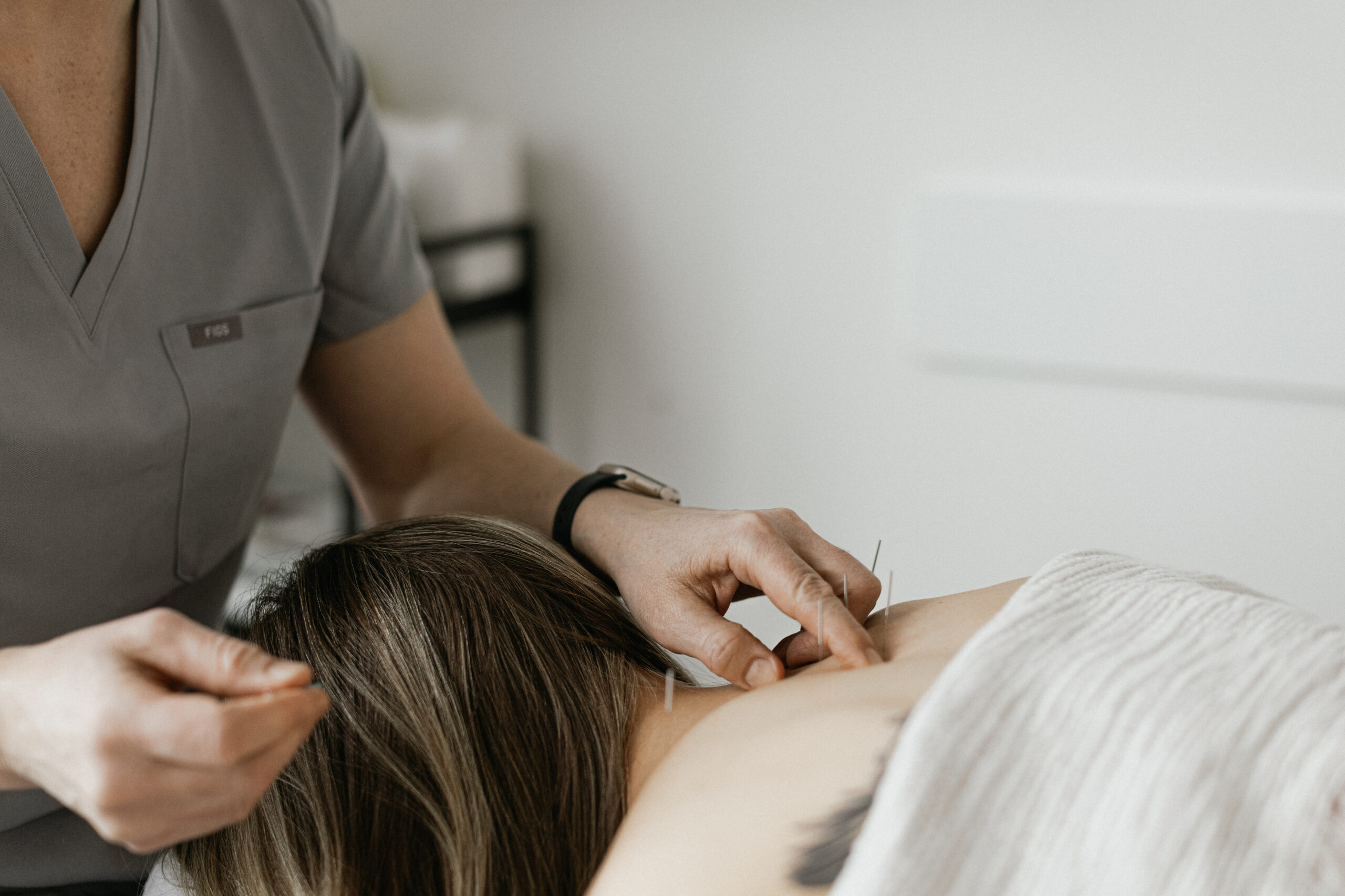 Acupuncture services at FridayHealth clinic