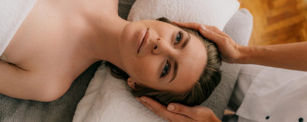 Woman receiving acupuncture therapy in a serene, indoor setting for wellness enhancement.