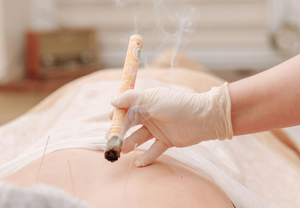 A moxibustion therapy session with acupuncture, showcasing traditional Chinese medicine techniques.